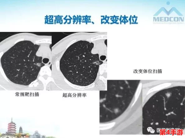 红桃ct:新研究显示红桃ct在早期癌症筛查中的潜力,引发医学界广泛关注与讨论 红桃ct:新研究显示红桃ct在早期癌症筛查中的潜力,引发医学界广泛关注与讨论