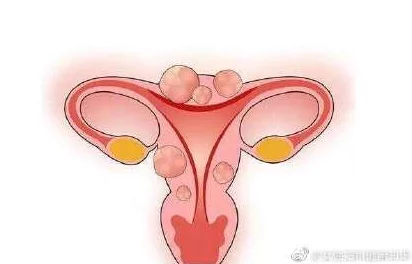 睾丸进入子宫的里面长肉粒正常吗?专家解读生殖健康与异常现象的关系 睾丸进入子宫的里面长肉粒正常吗?专家解读生殖健康与异常现象的关系